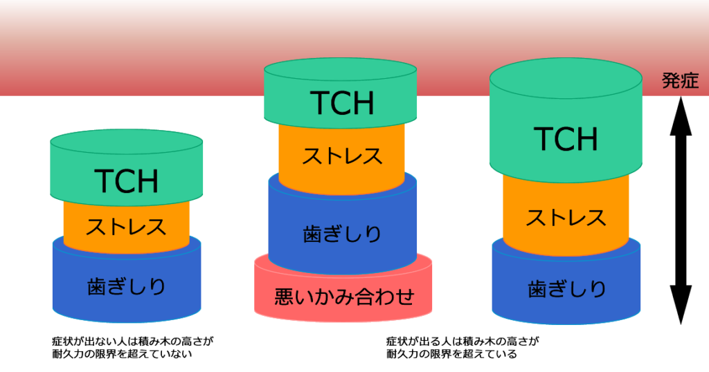 顎関節症の原因